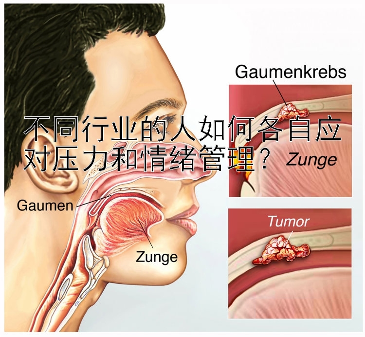 不同行业的人如何各自应对压力和情绪管理？