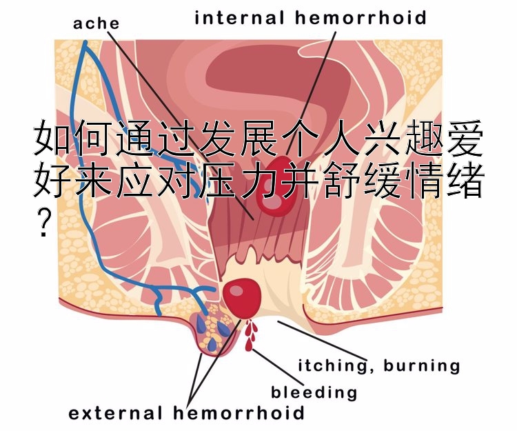 如何通过发展个人兴趣爱好来应对压力并舒缓情绪？